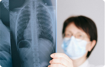 Pulmonology (Chest Diseases)